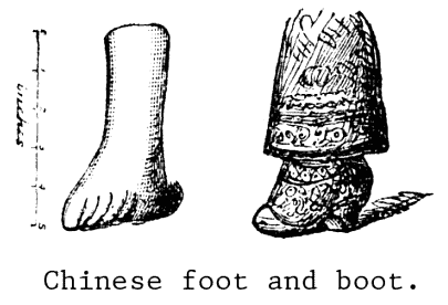 corns, feet, wrapping, Chinese, pain, foot, castor oil, kidney
